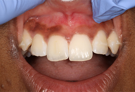 Jason S. Ehrenman, D.M.D. M.S.D.