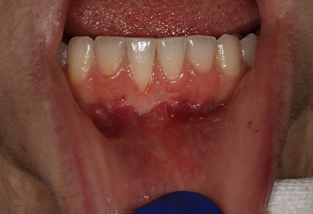 Jason S. Ehrenman, D.M.D. M.S.D.