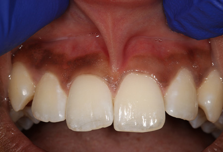 Jason S. Ehrenman, D.M.D. M.S.D.