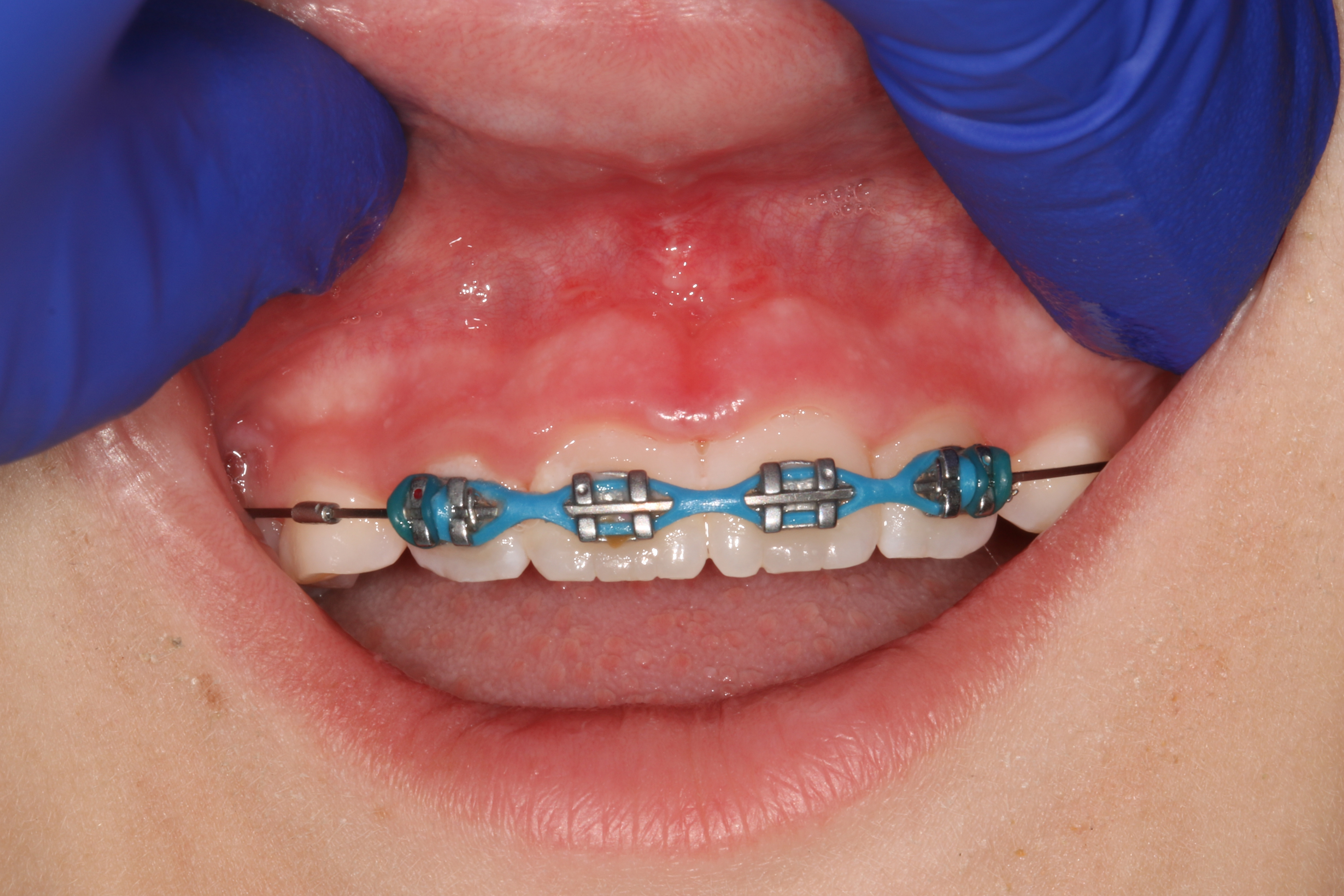 Jason S. Ehrenman, D.M.D. M.S.D.