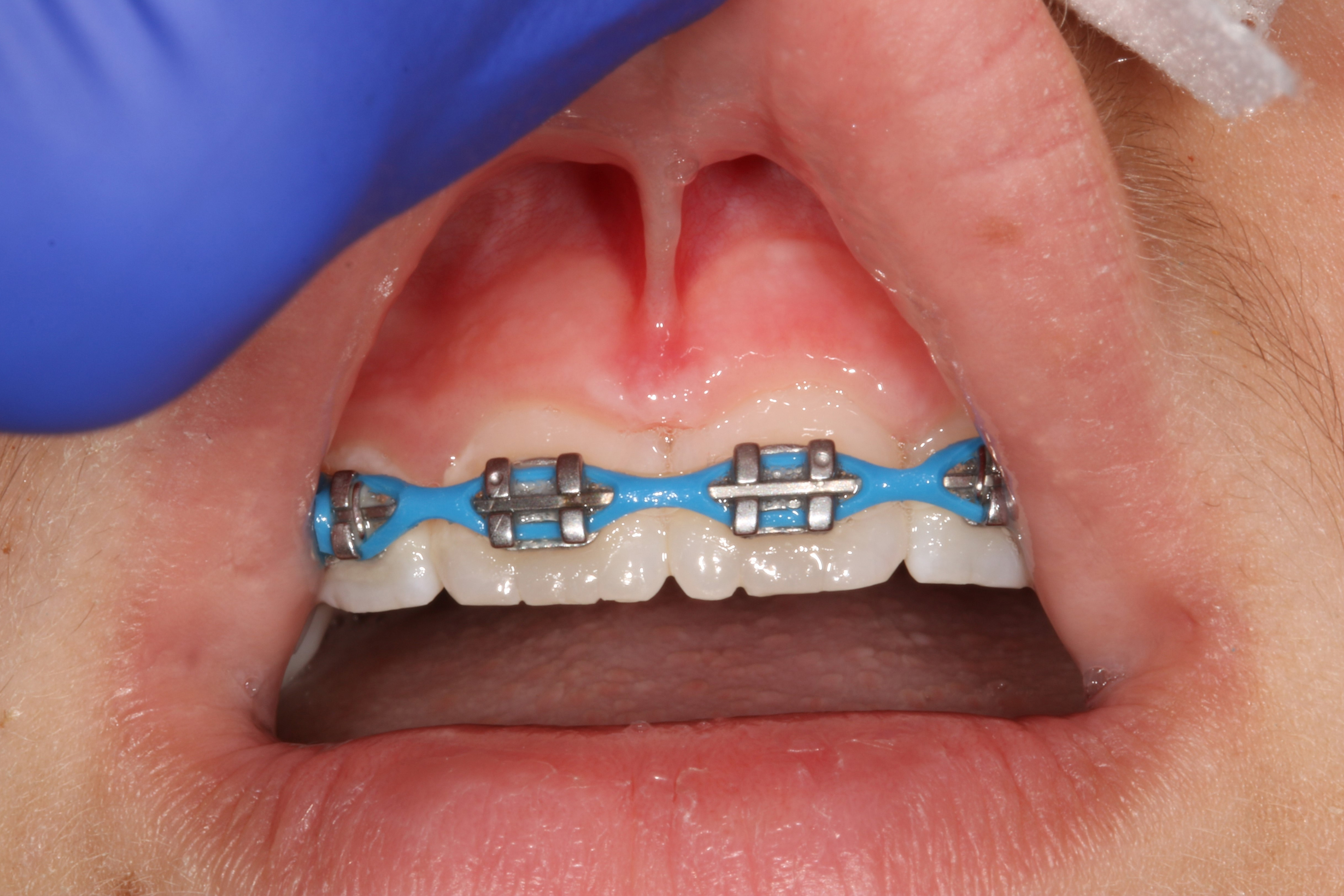 Jason S. Ehrenman, D.M.D. M.S.D.