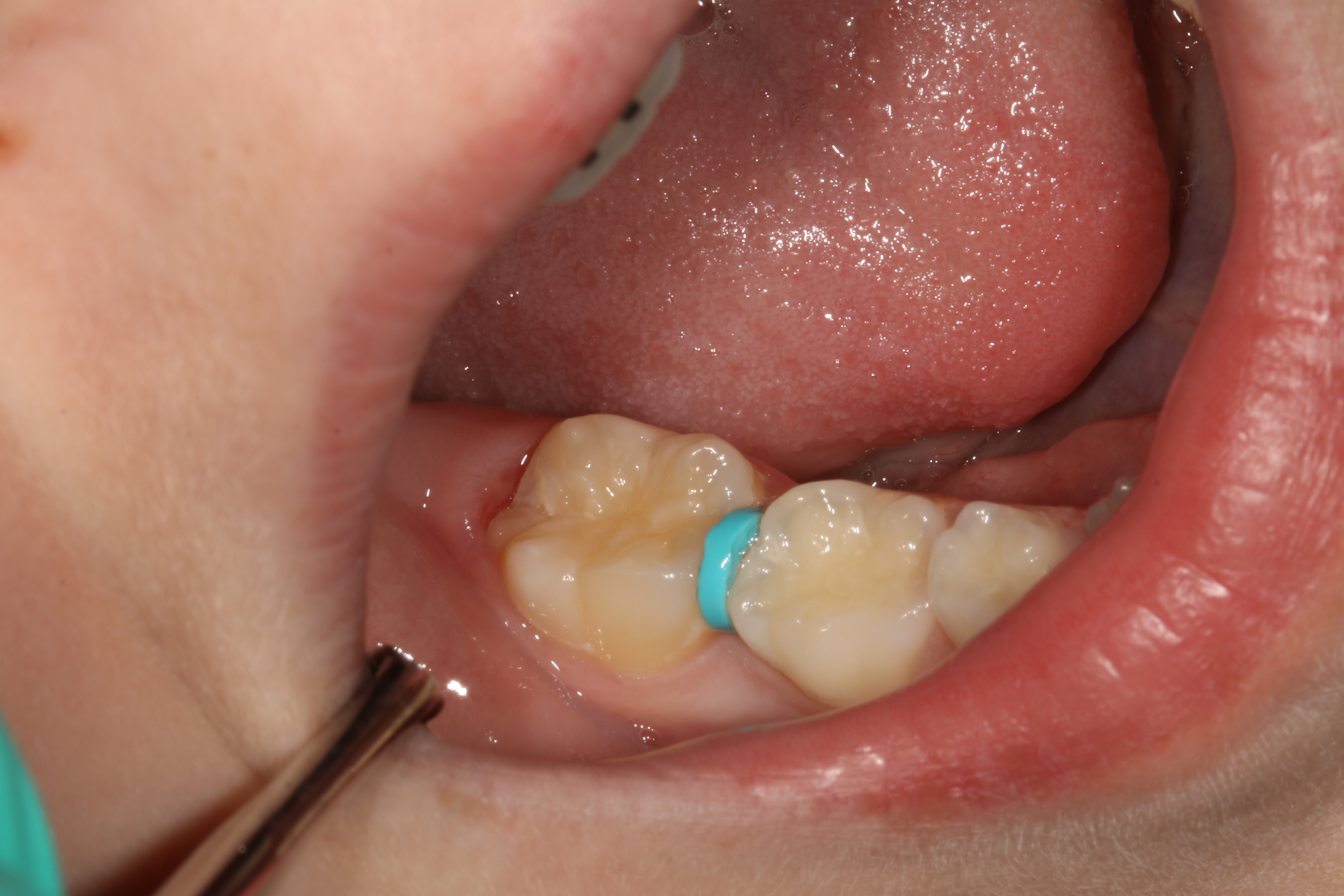 Jason S. Ehrenman, D.M.D. M.S.D.