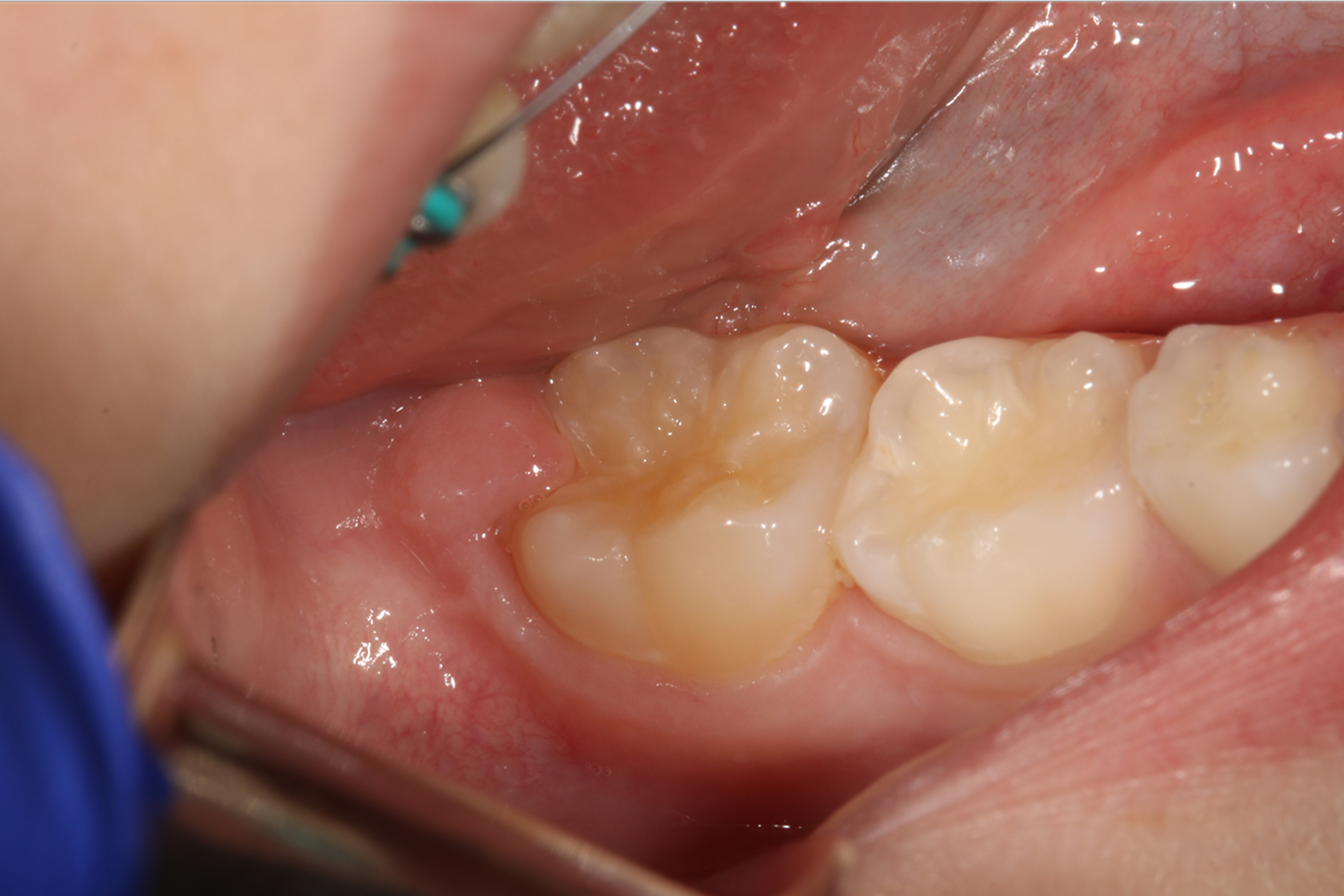 Jason S. Ehrenman, D.M.D. M.S.D.